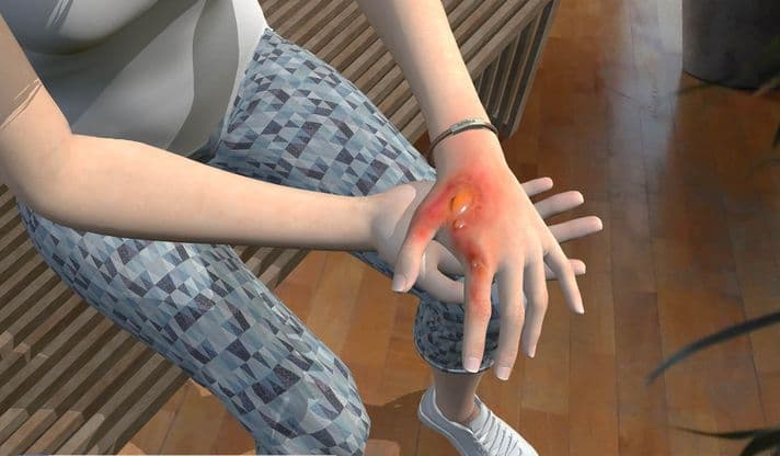 Injuries screenshot2